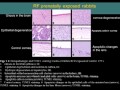 Cell Phone Dangers: <em>Dr. Devra Davis at National Institute of Environmental Health Sciences</em>