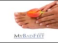 Toenail fungus treatment, Dr Maasi Smith