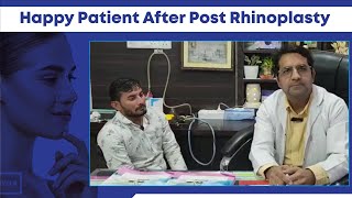Rhinoplasty Videos