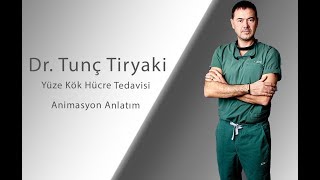 Dr. Tunç Tiryaki | Yüze Kök Hücre Tedavisi