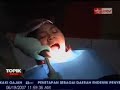 Dental Pit & Fissure Sealant