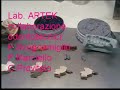 riabilitazione con impianti dentali Ankilos