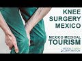 Knee Meniscus Arthroscopy Repair - Mexico Medical Tourism