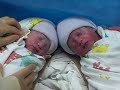 Hufana Twins Born On Date 01.08.09