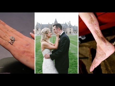 Boston Bombing: A Wedding and a Recovery