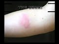 borrowed video, awesome contact staff moveshttp://www.firestaff-tutorials.co.uk/