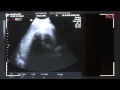Making Room For Multiples - GBMC Family Shares Their Story on TLC (Part 2)