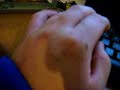 Warum Zuckt mein Finger so