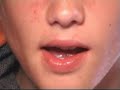 Thumbnail #1