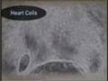 'Embryonic' from Skin