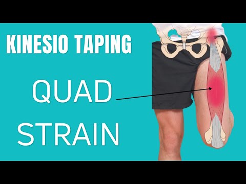 how to treat quad pull