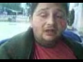 Na vrh brda vrba mrda....
