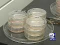 Stem Cells Made From Human Skin Stem Cells Made From Human Skin