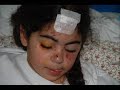 Reporte Israel: Resolución de la ONU llama al cese el fuego en Gaza - 09/01/09