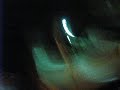 ahh,, ayer en el auto, mui pedorro