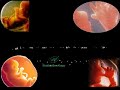 Click here to watch this video Aborsi