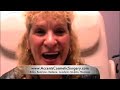 Cheek Rejuvenation with Radiessse, Lips with Restylane, Face Thermage Cheek Rejuvenation with Radiessse, Lips with Restylane, Face Thermage