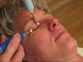 second-chance-facial-rejuvenationlook-younger-in-30-minutes.html