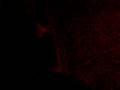 videos de ultrasound 2 of 4