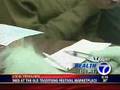 Healthbeat - Shingles