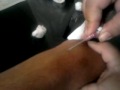 Poniendole su suero a Bryant