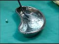 endoscopia la historia no contada parte 5  5/7 