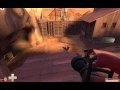 Intermission - Medic on Dustbowl