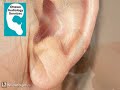 Ottawa Audiology Services - Ottawa