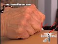 Introduction to Acupuncture - CMS Introduction to Acupuncture - CMS