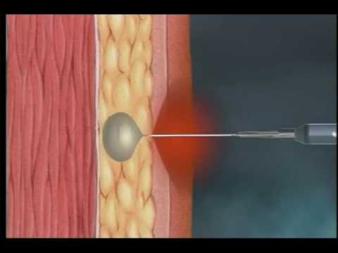 how to administer vaccines