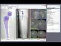 HipOp planning software (2)