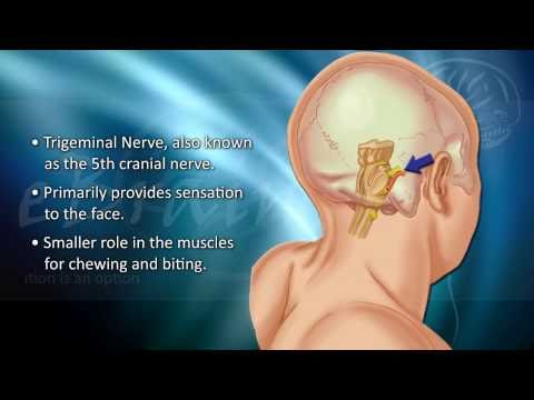 how to cure trigeminal neuralgia