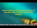 Natural Acne Treatments or Prescription Medicine?