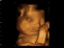 4d baby scan of  michelle  and david