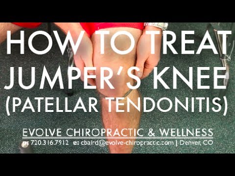 how to treat jumper's knee