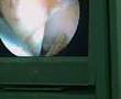 cirurgia de LCA