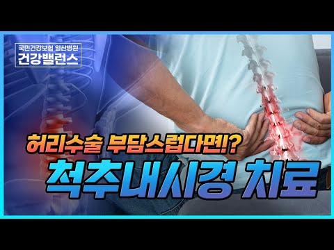 [건강밸런스]허리수술 부담스럽다면!? 척추내시경 치료