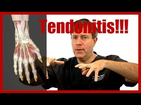 how to treat tendonitis in wrist