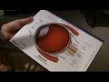 LaGrange EYE CARE #3 LaGrange EYE CARE #3