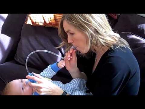 how to relieve congestion in a baby