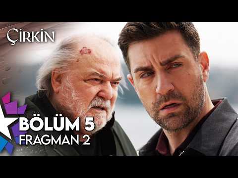 Çirkin 5. Bölüm 2. Fragmanı                                                                                                                                                                                                                               