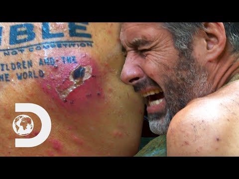 Necrotic Mosquito Bite Has To Be Removed Before This Man's Flesh Is Eaten | Naked And Afraid: Alone