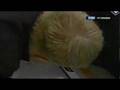 Malkin's Shoulder Dislocation