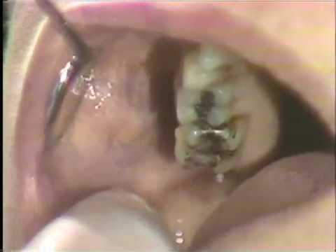 oral pics