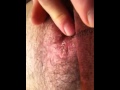 Boil rob