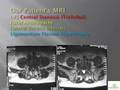 Spinal Stenosis Treatment Alternatives by Pablo Pazmino, MD