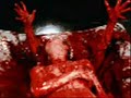 Last Days of Humanity-malignant haemorhage