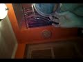 popp cyst wilkes barre