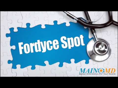 how to treat fordyce spots