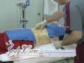 Liposculpture procedure. Body Care...